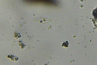 Scheletro di diatomea?